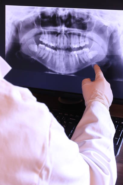 Best Emergency Tooth Extraction in Plainville, KS