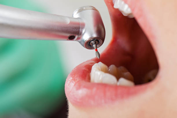 Best Emergency Broken Tooth Repair in Plainville, KS